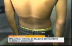 Criança de 11 anos é agredida com chicotada em Bacabal