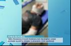 Três pessoas ficam feridas após ataque de cão da raça pitbull no Maiobão